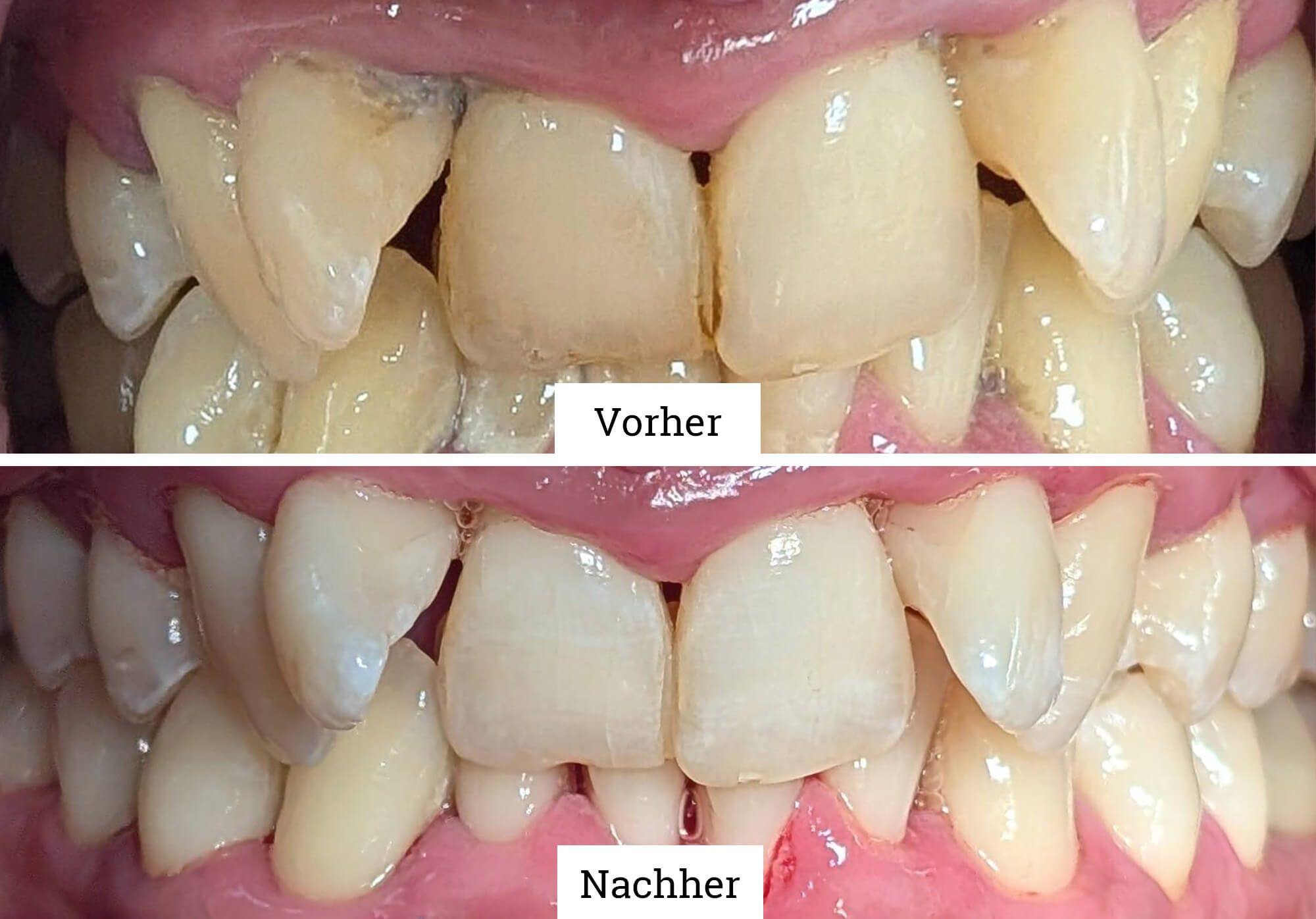 Vor3 (1)