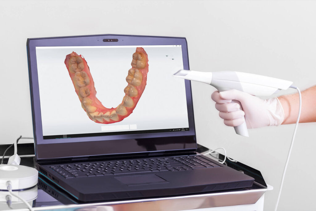 Intraoralscanner